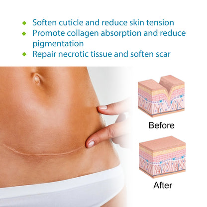 Self-Adhesive Silicone Scar Repair Orange Line Growth Line Smooth Skin Care Beauty Patch