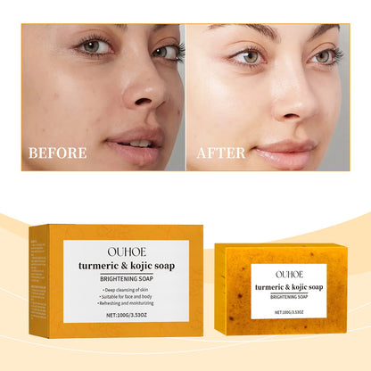 Lemon Turmeric Brightening Soap Gently Cleanses The Skin, Moisturizes, Hydrates And Replenishes Water. It Is A Facial And Body Care Soap