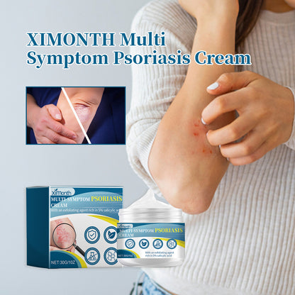 Ximonth Psoriasis Treatment Cream Repair Hand, Foot And Body Moss Redness And Itchy Skin Topical Treatment Cream